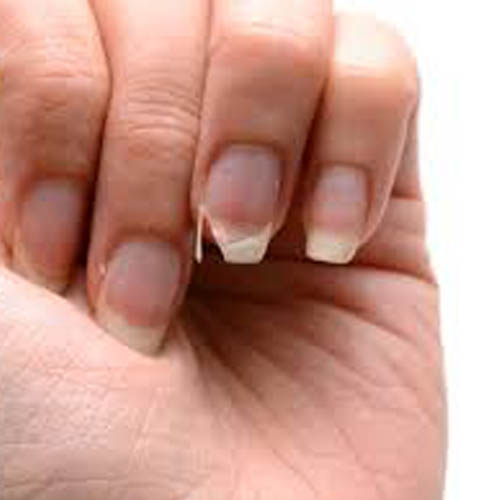 reparation ongle allauch